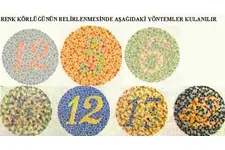 Renk Körlüğü Ameliyatı Riskleri ve Sonrası